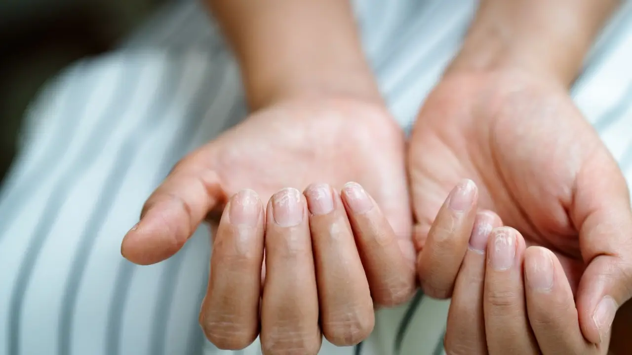 Unghie che si spezzano? Non è carenza di vitamine, ma un segnale che il tuo corpo ti sta inviando